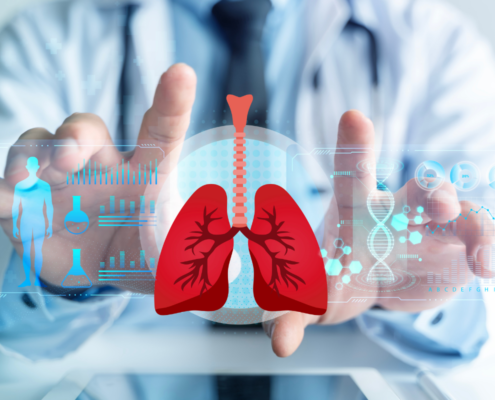 Foto com aproximação nas mãos de um médico sentado frente a uma projeção digital do pulmão e dados do paciente para representar os procedimentos de embolia pulmonar